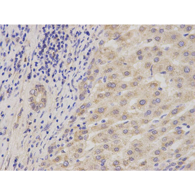 Immunohistochemistry - ADAM9 Antibody from Signalway Antibody (32822) - Antibodies.com