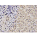 Immunohistochemistry - ADAM9 Antibody from Signalway Antibody (32822) - Antibodies.com