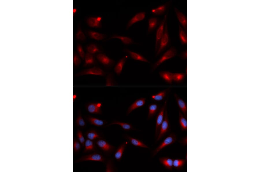 Immunofluorescence - ADAM9 Antibody from Signalway Antibody (32822) - Antibodies.com