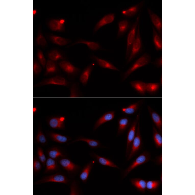 Immunofluorescence - ADAM9 Antibody from Signalway Antibody (32822) - Antibodies.com