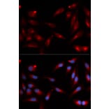 Immunofluorescence - ADAM9 Antibody from Signalway Antibody (32822) - Antibodies.com