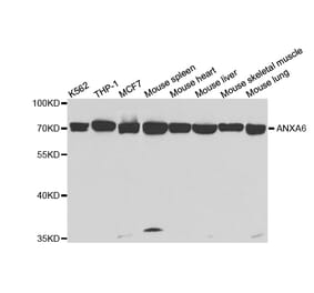 Western blot - ANXA6 Antibody from Signalway Antibody (32824) - Antibodies.com
