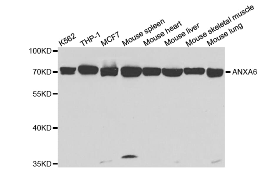 Western blot - ANXA6 Antibody from Signalway Antibody (32824) - Antibodies.com