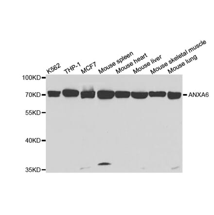 Western blot - ANXA6 Antibody from Signalway Antibody (32824) - Antibodies.com