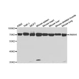 Western blot - ANXA6 Antibody from Signalway Antibody (32824) - Antibodies.com