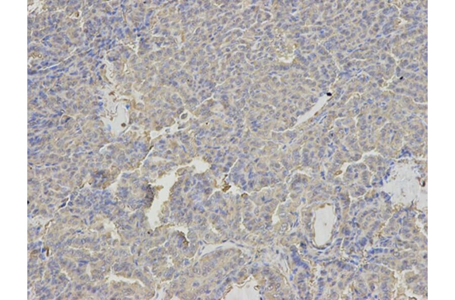 Immunohistochemistry - ANXA6 Antibody from Signalway Antibody (32824) - Antibodies.com