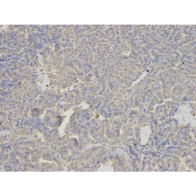 Immunohistochemistry - ANXA6 Antibody from Signalway Antibody (32824) - Antibodies.com