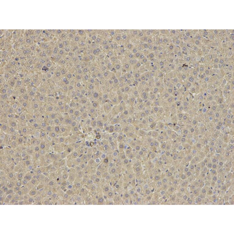 Immunohistochemistry - ANXA6 Antibody from Signalway Antibody (32824) - Antibodies.com