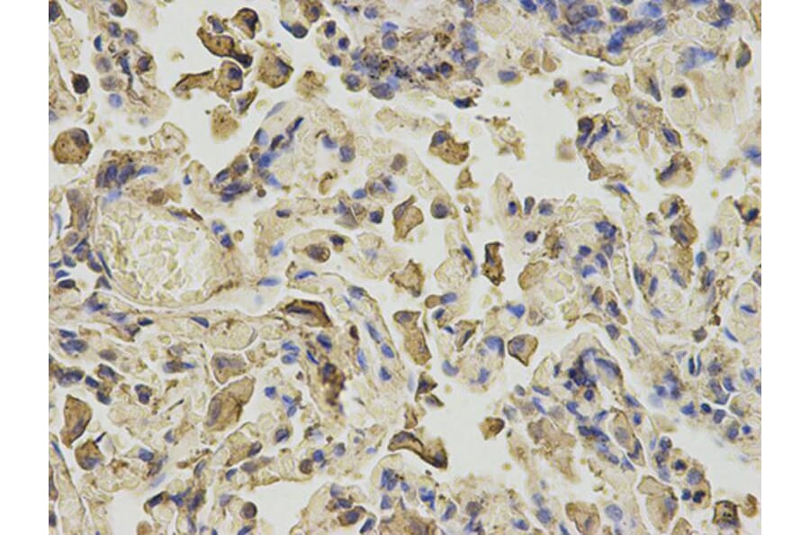 Immunohistochemistry - ANXA6 Antibody from Signalway Antibody (32824) - Antibodies.com