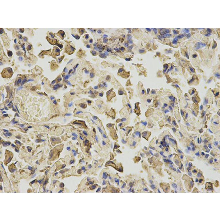 Immunohistochemistry - ANXA6 Antibody from Signalway Antibody (32824) - Antibodies.com