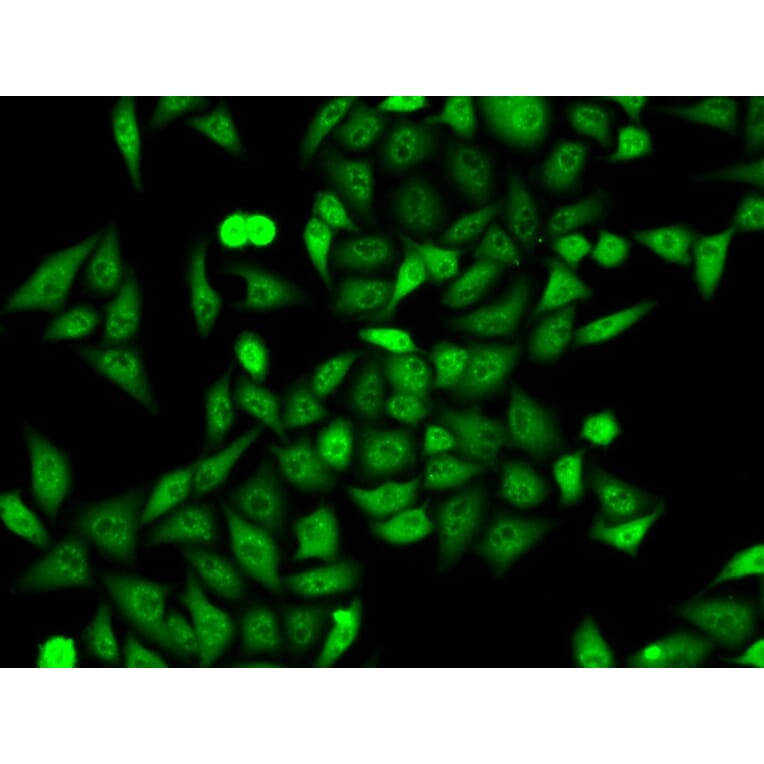 Immunofluorescence - ANXA6 Antibody from Signalway Antibody (32824) - Antibodies.com