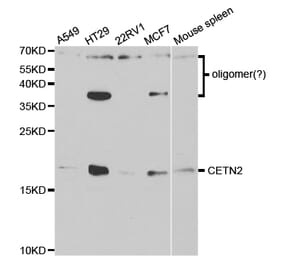 Western blot - CETN2 Antibody from Signalway Antibody (32827) - Antibodies.com