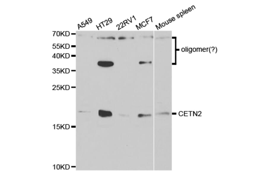Western blot - CETN2 Antibody from Signalway Antibody (32827) - Antibodies.com