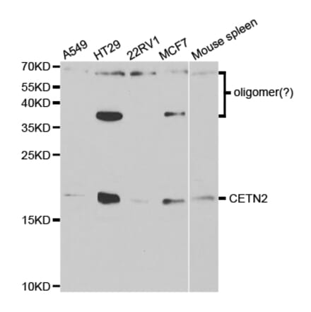 Western blot - CETN2 Antibody from Signalway Antibody (32827) - Antibodies.com