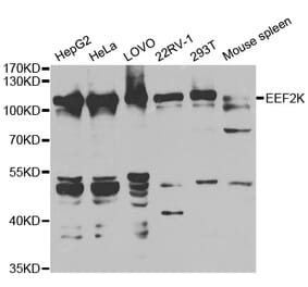 Western blot - EEF2K Antibody from Signalway Antibody (32832) - Antibodies.com