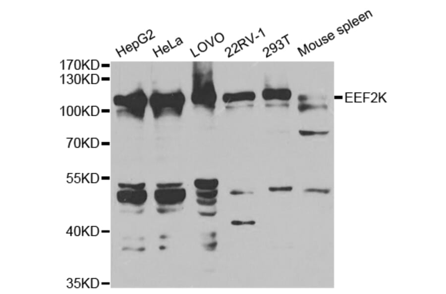 Western blot - EEF2K Antibody from Signalway Antibody (32832) - Antibodies.com