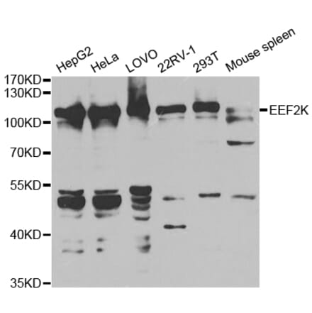 Western blot - EEF2K Antibody from Signalway Antibody (32832) - Antibodies.com