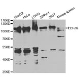 Western blot - EEF2K Antibody from Signalway Antibody (32832) - Antibodies.com