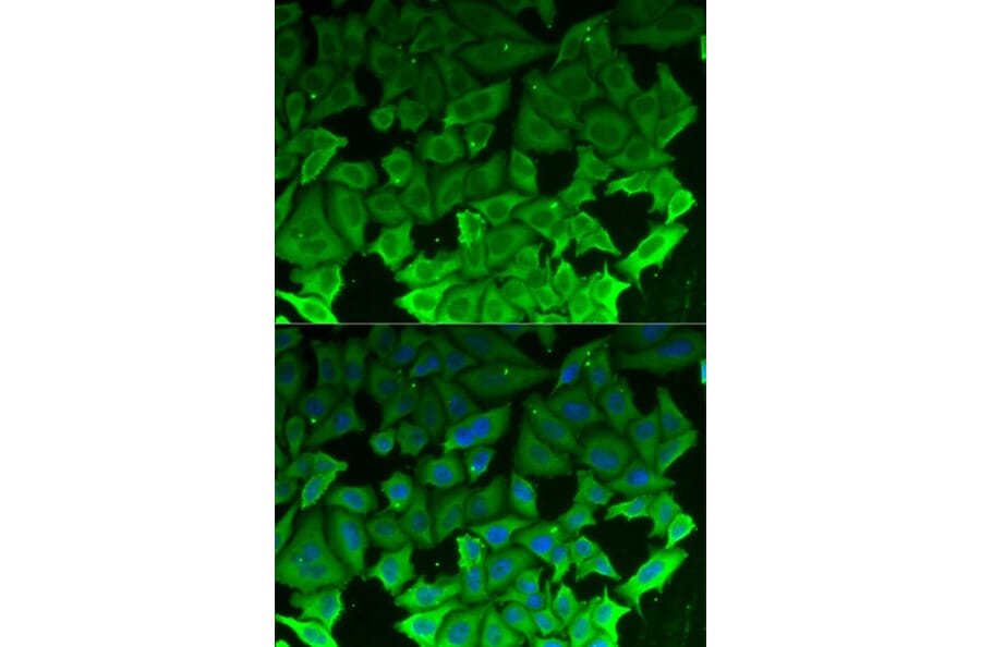 Immunofluorescence - EEF2K Antibody from Signalway Antibody (32832) - Antibodies.com