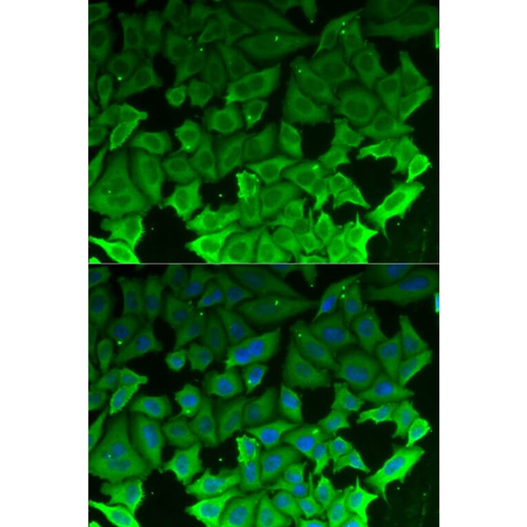 Immunofluorescence - EEF2K Antibody from Signalway Antibody (32832) - Antibodies.com