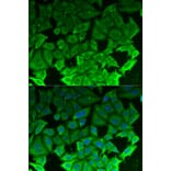 Immunofluorescence - EEF2K Antibody from Signalway Antibody (32832) - Antibodies.com