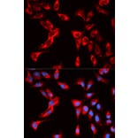 Immunofluorescence - EIF4B Antibody from Signalway Antibody (32833) - Antibodies.com