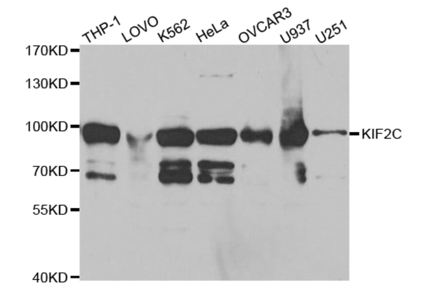 Western blot - KIF2C Antibody from Signalway Antibody (32855) - Antibodies.com
