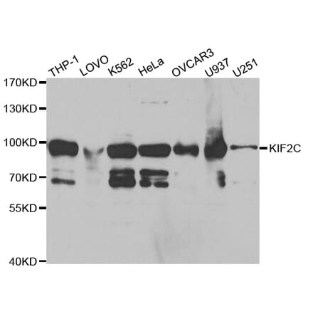 Western blot - KIF2C Antibody from Signalway Antibody (32855) - Antibodies.com