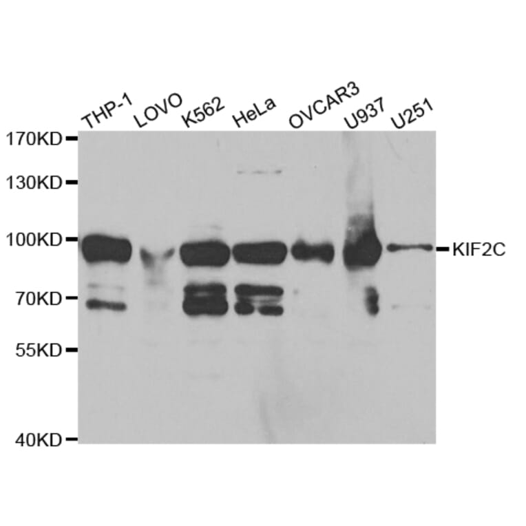 Western blot - KIF2C Antibody from Signalway Antibody (32855) - Antibodies.com