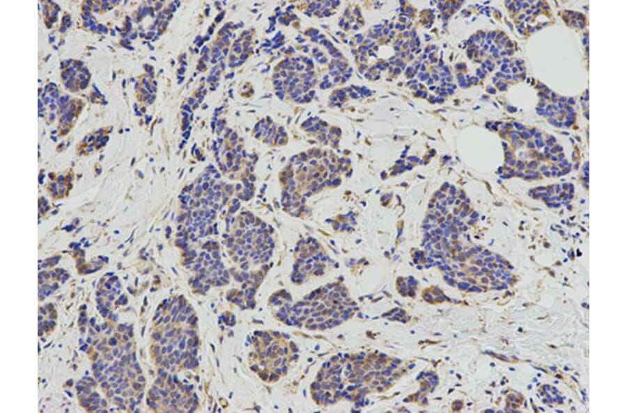 Immunohistochemistry - KIF2C Antibody from Signalway Antibody (32855) - Antibodies.com