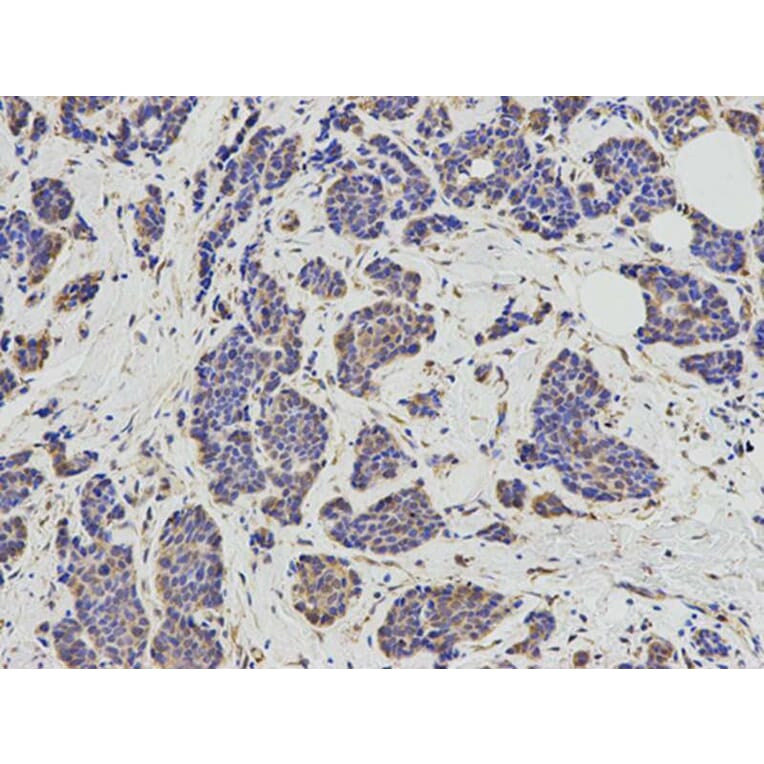 Immunohistochemistry - KIF2C Antibody from Signalway Antibody (32855) - Antibodies.com