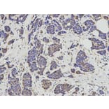 Immunohistochemistry - KIF2C Antibody from Signalway Antibody (32855) - Antibodies.com