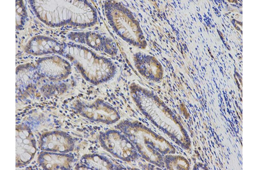 Immunohistochemistry - KIF2C Antibody from Signalway Antibody (32855) - Antibodies.com