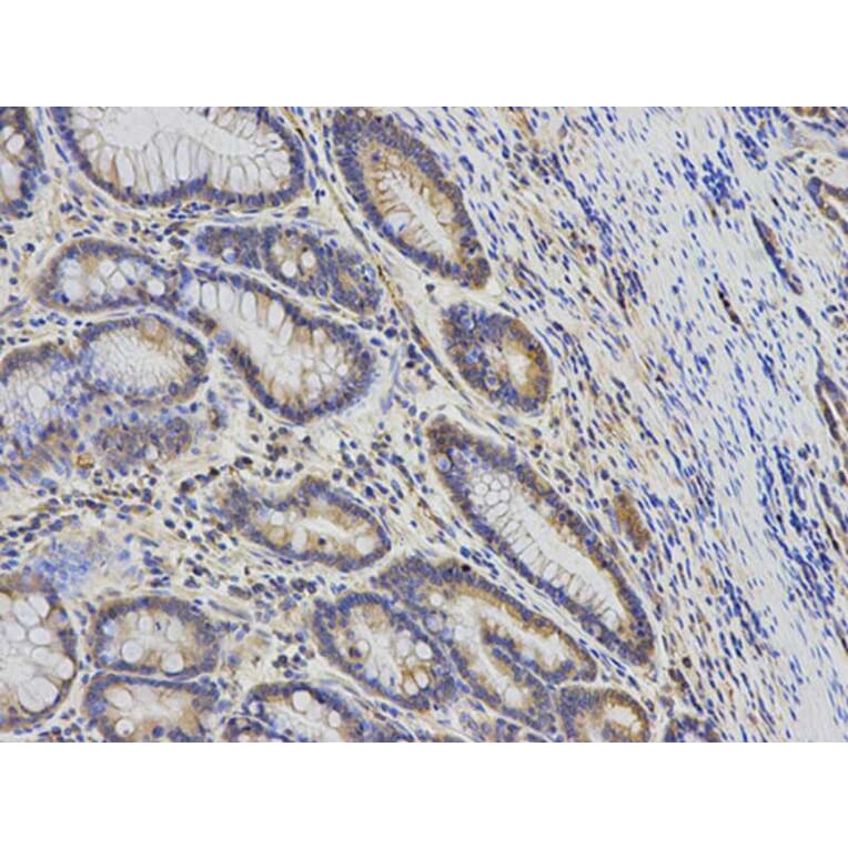 Immunohistochemistry - KIF2C Antibody from Signalway Antibody (32855) - Antibodies.com