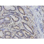 Immunohistochemistry - KIF2C Antibody from Signalway Antibody (32855) - Antibodies.com
