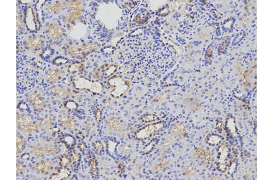 Immunohistochemistry - KIF2C Antibody from Signalway Antibody (32855) - Antibodies.com