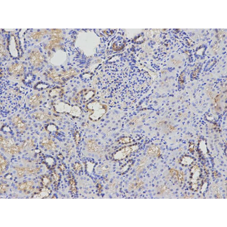 Immunohistochemistry - KIF2C Antibody from Signalway Antibody (32855) - Antibodies.com