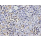 Immunohistochemistry - KIF2C Antibody from Signalway Antibody (32855) - Antibodies.com