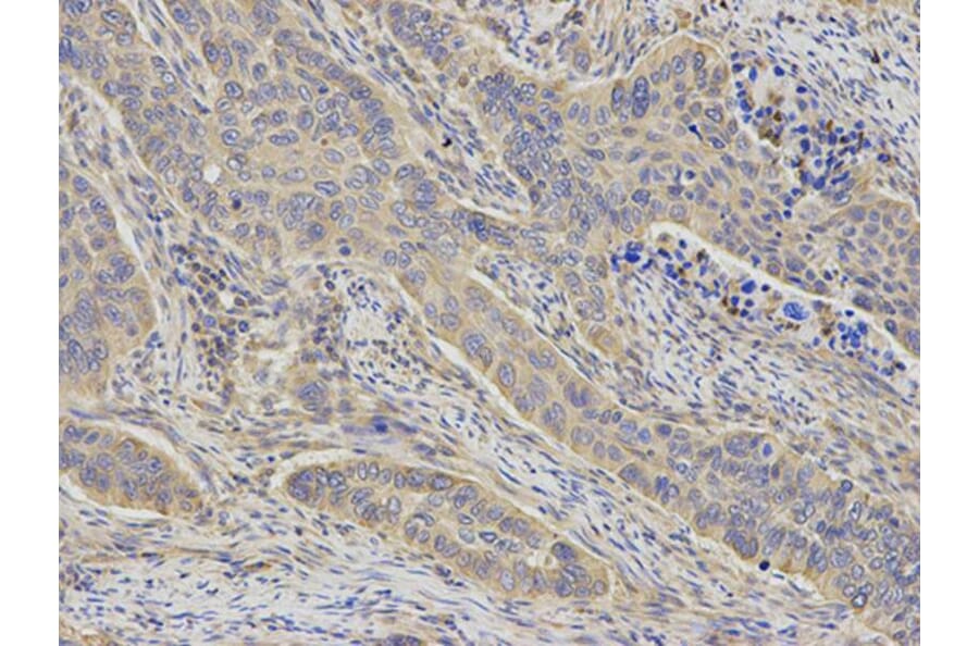 Immunohistochemistry - KIF2C Antibody from Signalway Antibody (32855) - Antibodies.com