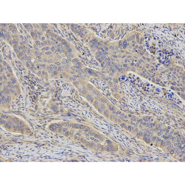 Immunohistochemistry - KIF2C Antibody from Signalway Antibody (32855) - Antibodies.com