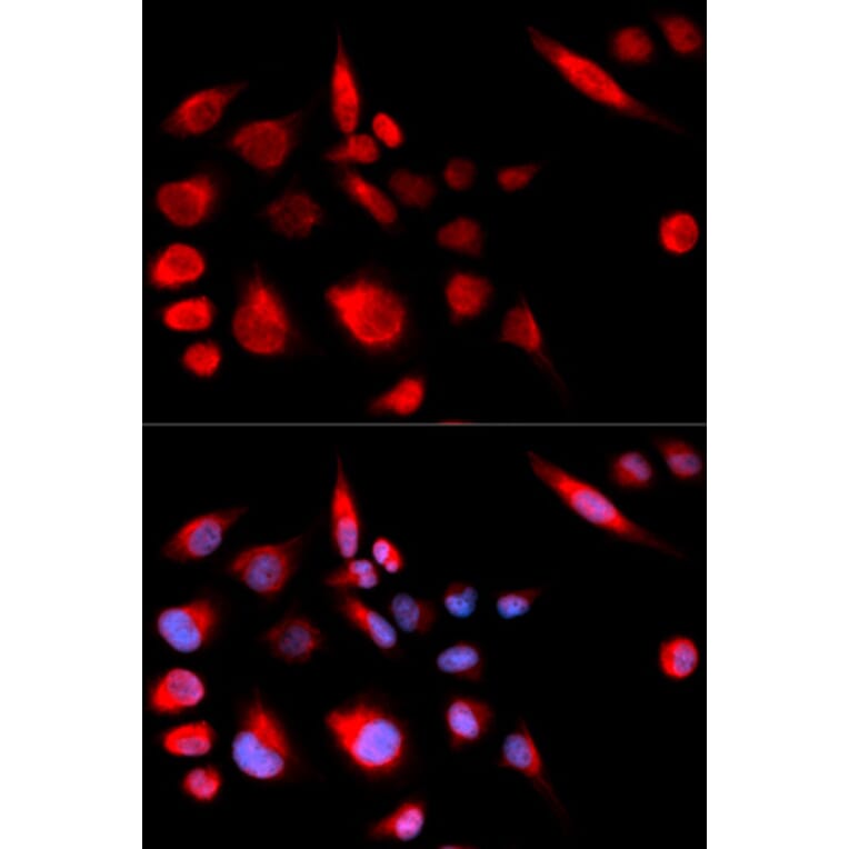 Immunofluorescence - KIF2C Antibody from Signalway Antibody (32855) - Antibodies.com