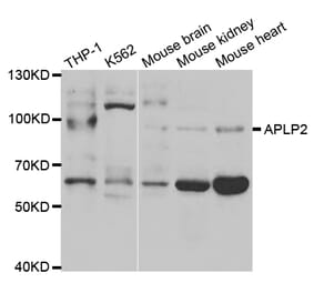 Western blot - APLP2 Antibody from Signalway Antibody (32858) - Antibodies.com
