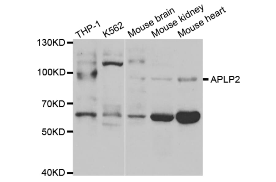 Western blot - APLP2 Antibody from Signalway Antibody (32858) - Antibodies.com