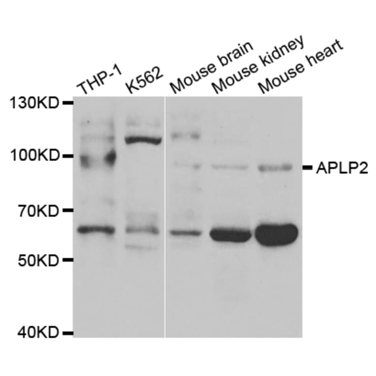 Western blot - APLP2 Antibody from Signalway Antibody (32858) - Antibodies.com