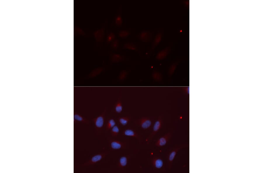Immunofluorescence - APLP2 Antibody from Signalway Antibody (32858) - Antibodies.com