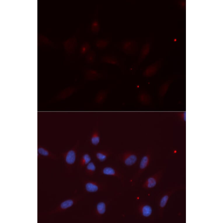 Immunofluorescence - APLP2 Antibody from Signalway Antibody (32858) - Antibodies.com