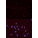 Immunofluorescence - APLP2 Antibody from Signalway Antibody (32858) - Antibodies.com