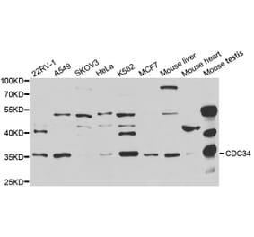 Western blot - CDC34 Antibody from Signalway Antibody (32860) - Antibodies.com