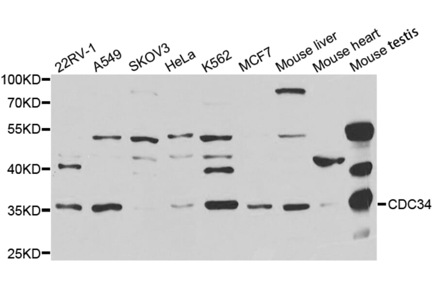 Western blot - CDC34 Antibody from Signalway Antibody (32860) - Antibodies.com