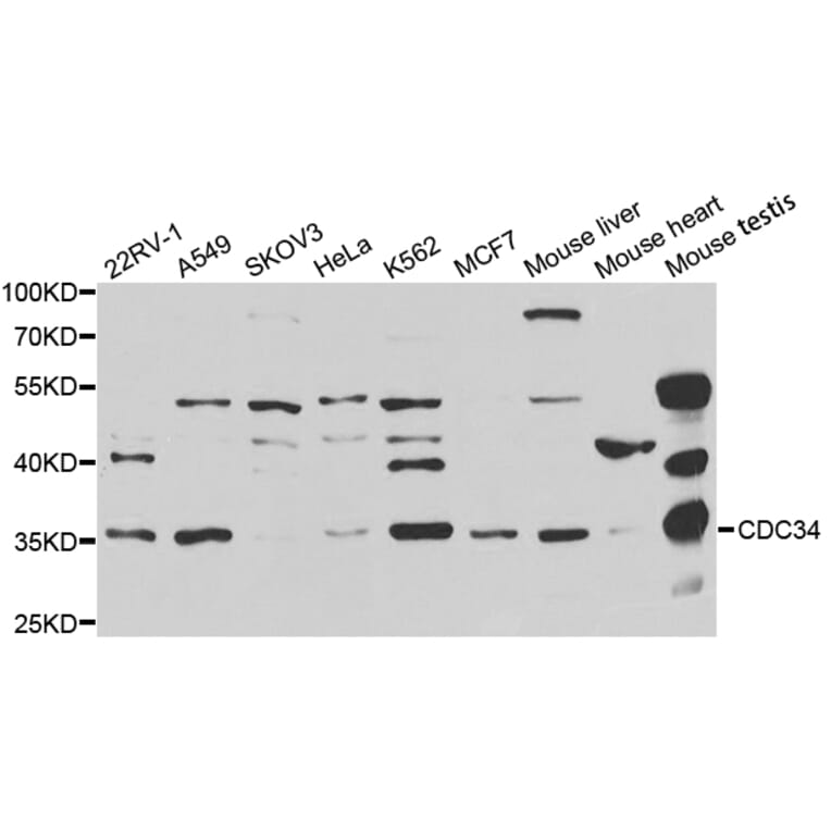 Western blot - CDC34 Antibody from Signalway Antibody (32860) - Antibodies.com